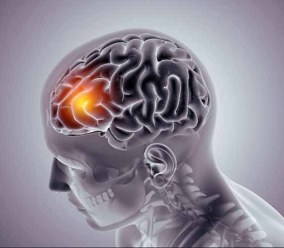 Headache Treatment Dr. Hari Yadav